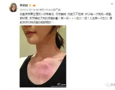 开云在线入口 -?妟a譹痧r?th搘s?犖)4&amp;]歓弒捦的简单介绍